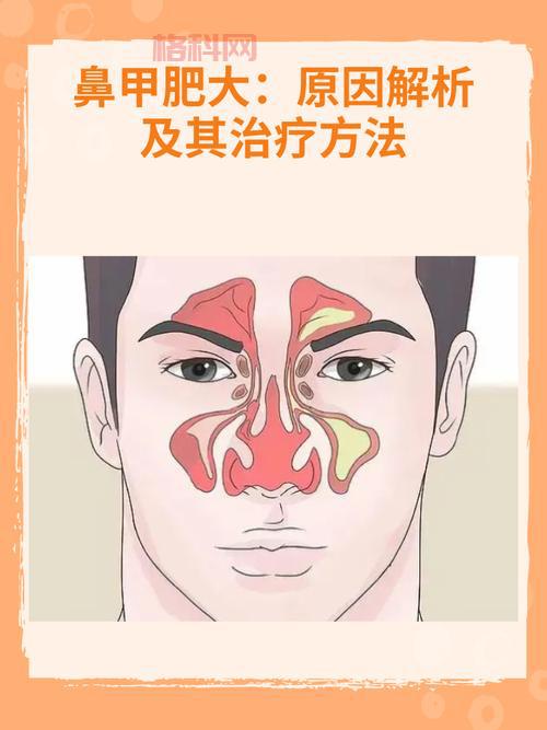 抑郁症患者嗜睡成因解析：如何识别并早期干预